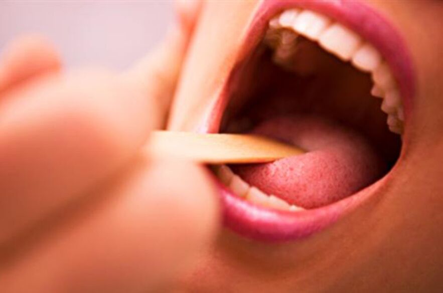 odam og'zida parazitlarning turlari